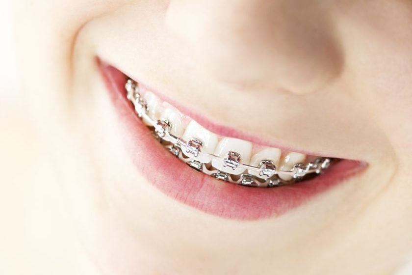 orthodontie
